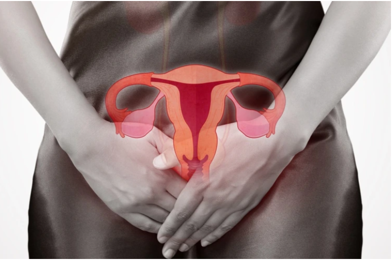 Retroverted Or Tilted Uterus | An Obstacle To Your Fertility?