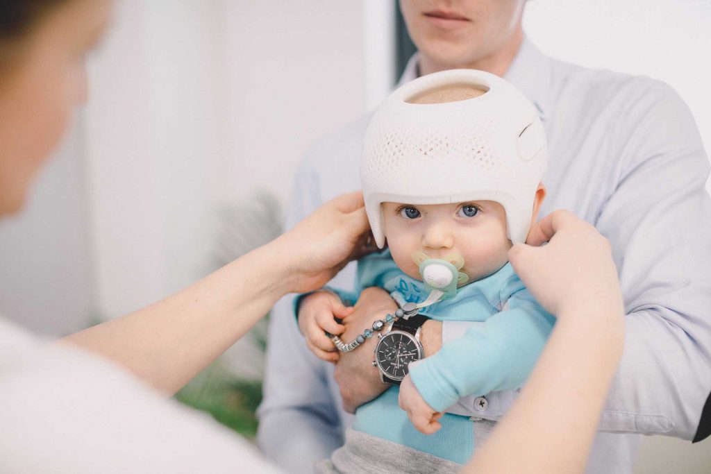 A corrective helmet, or CRO, is a custom-made medical device used to address plagiocephaly in children with moderate-to-severe skull asymmetry.
