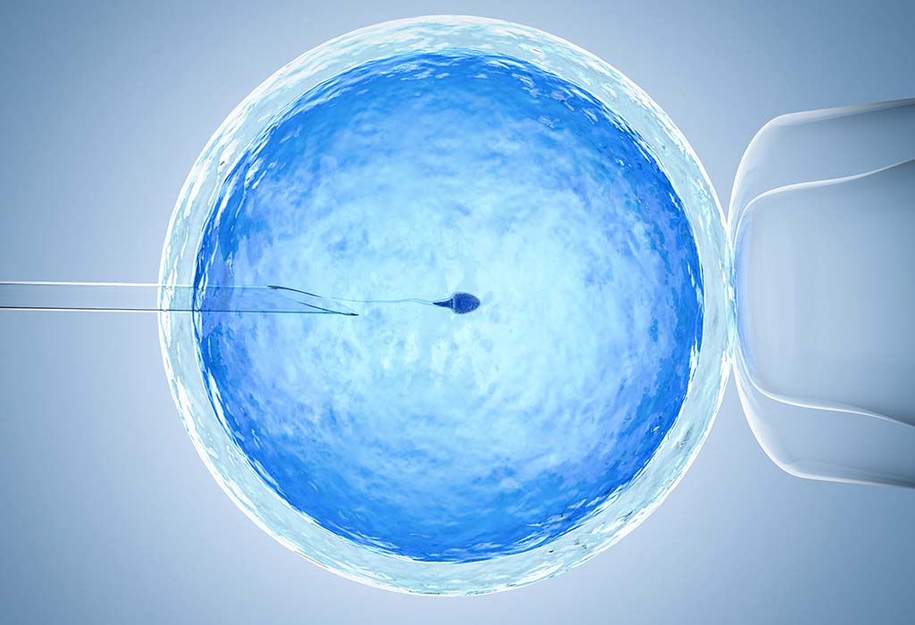 Another option available to those with a diminished ovarian reserve is In Vitro Fertilization (IVF) using Donor eggs.