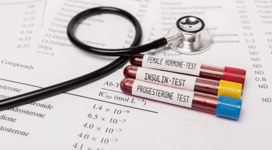 A blood test is one of the most common ways to test hormone levels. 